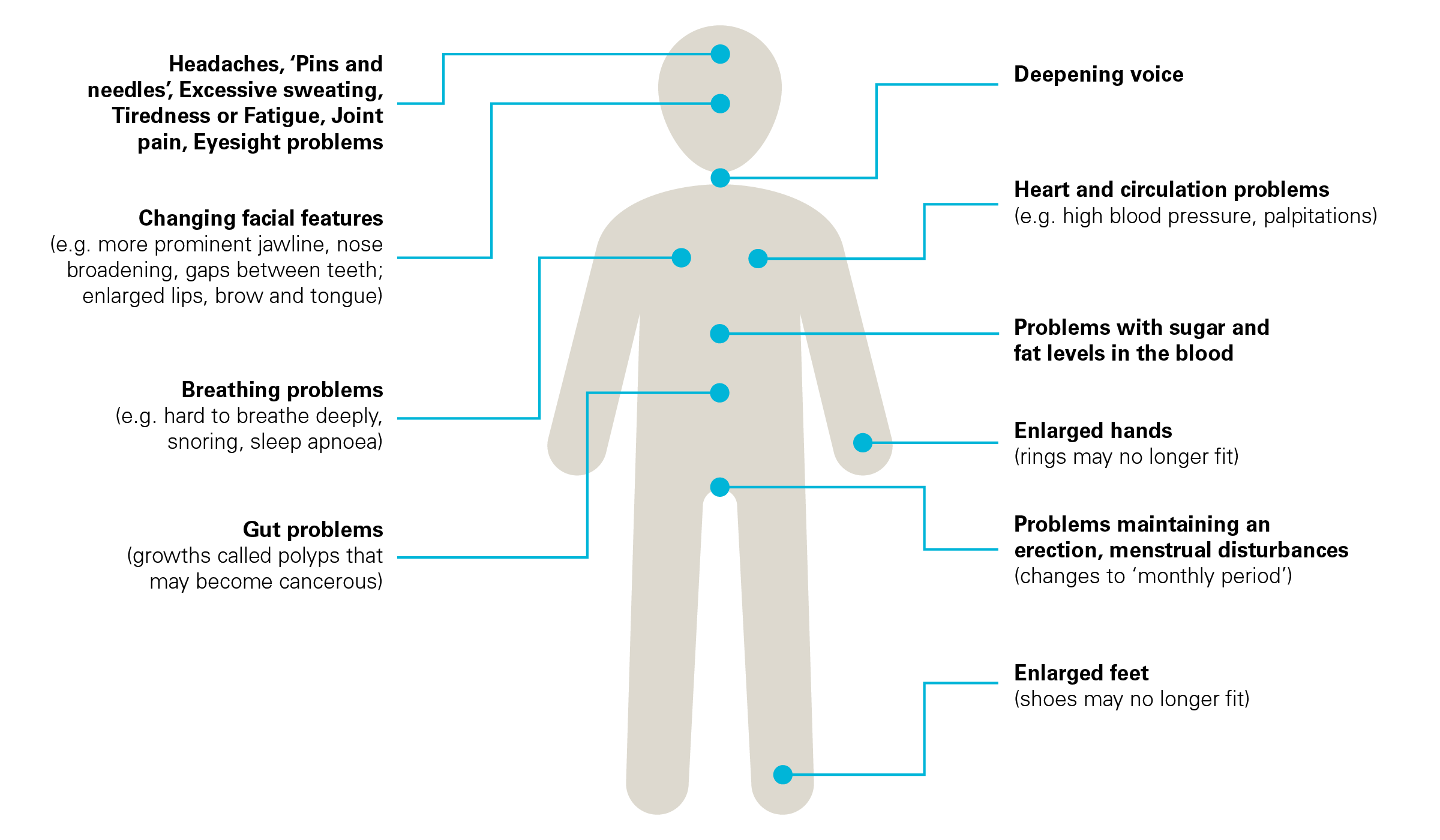 Acromegaly symptoms
