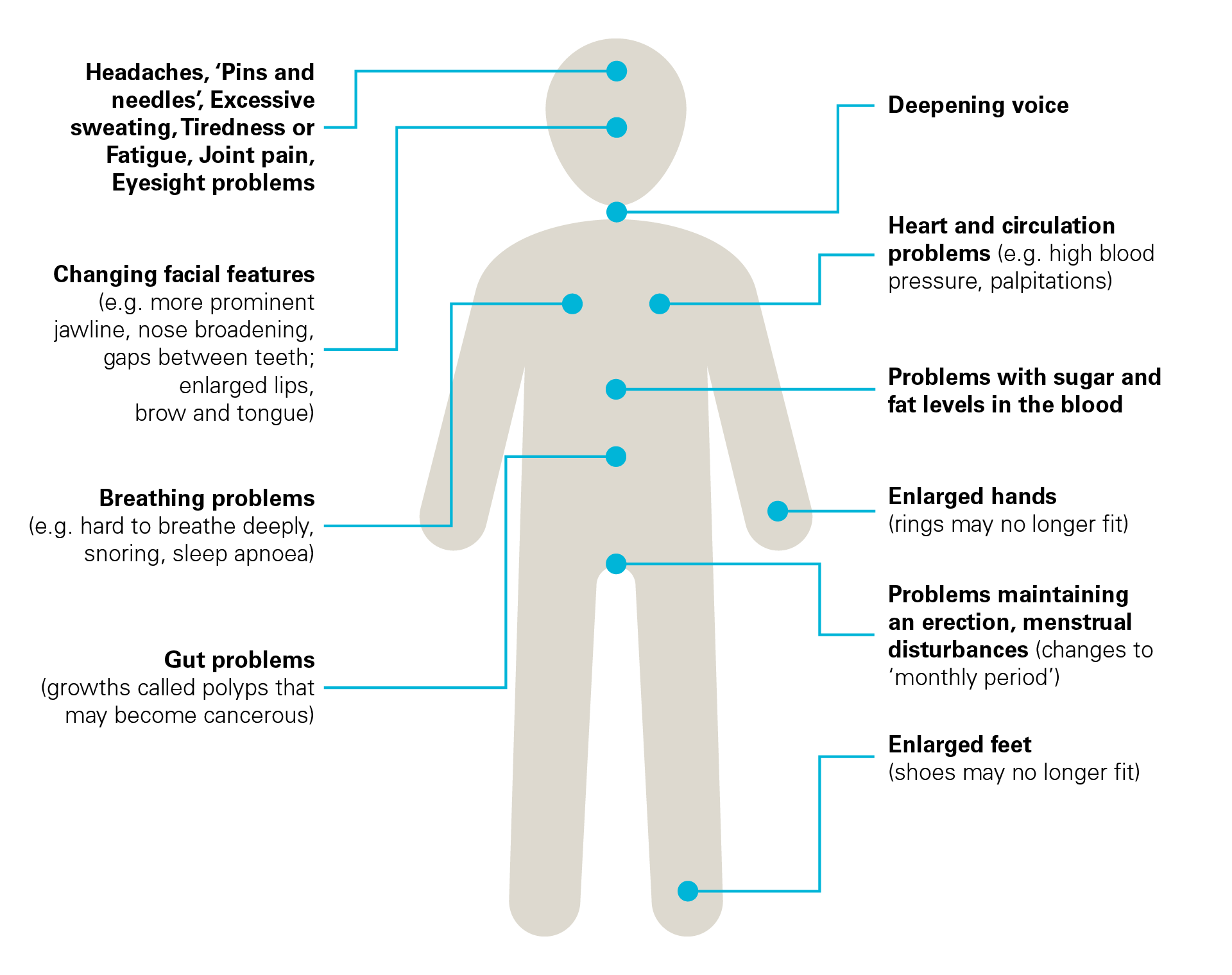 Acromegaly symptoms