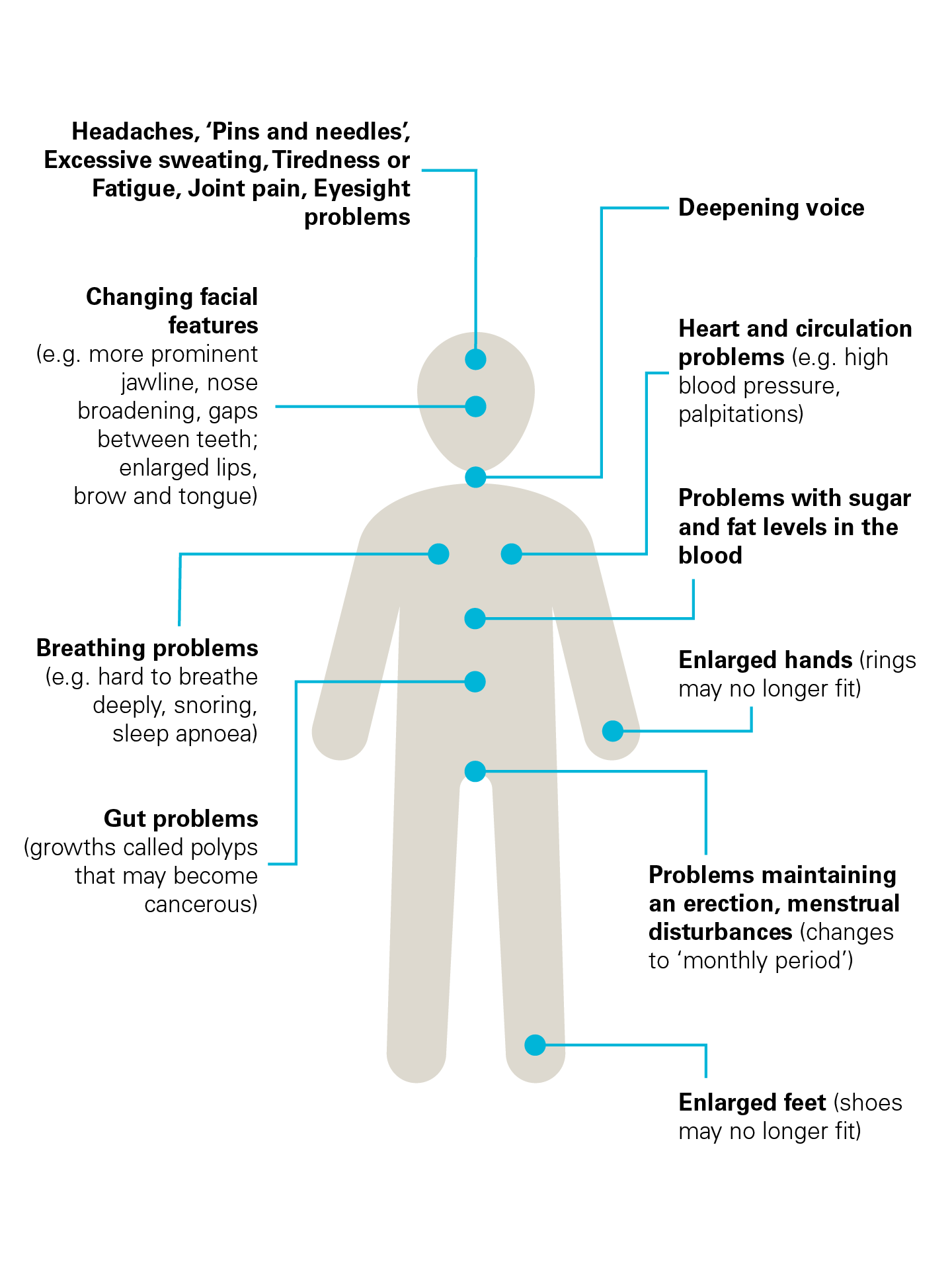 Acromegaly symptoms