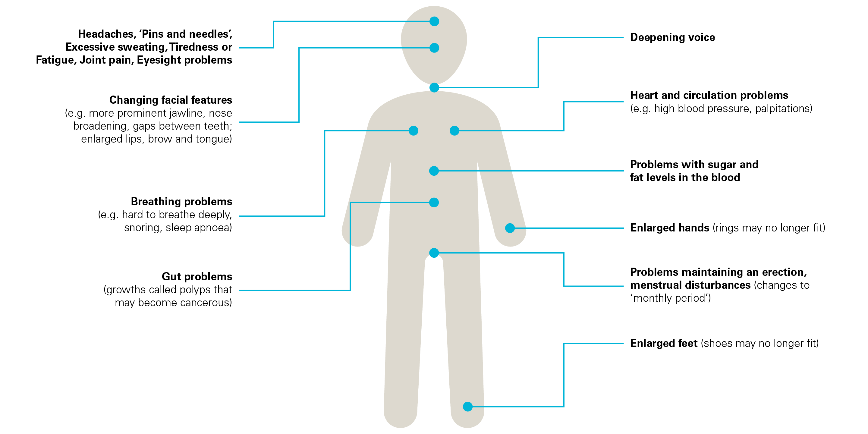 Acromegaly symptoms