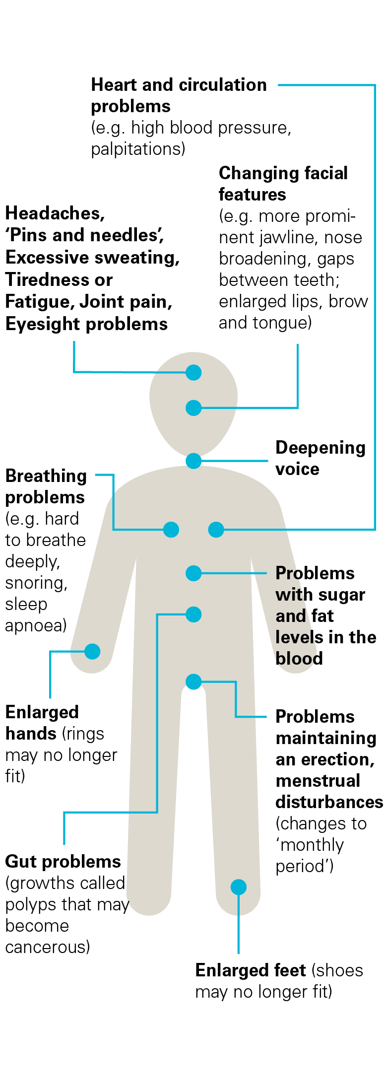 Acromegaly symptoms